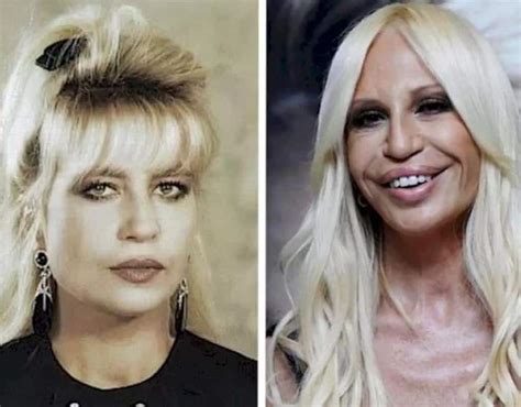 qui est donatella versace|what happened to donatella versace's face.